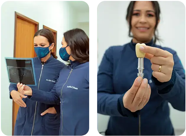 Saúde Center Odontologia | Implantes Dentários